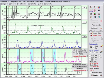 Software para vídeo-manometria, manometria esofágica e manometria biliar.